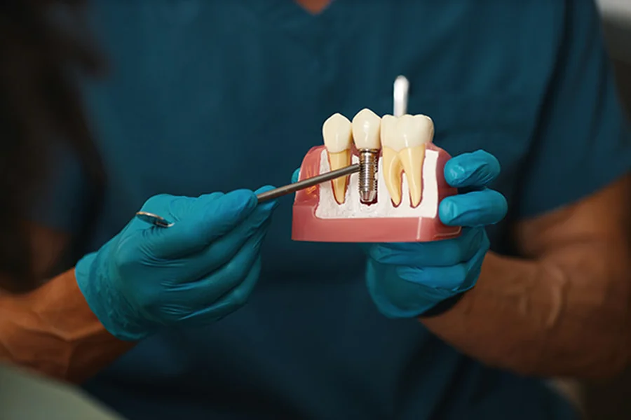 Dental Implant